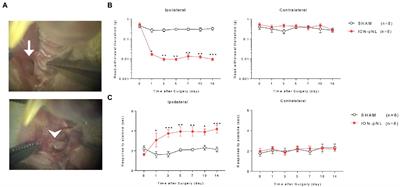 The mTOR inhibitor rapamycin suppresses trigeminal neuropathic pain and p-MKK4/p-p38 mitogen-activated protein kinase-mediated microglial activation in the trigeminal nucleus caudalis of mice with infraorbital nerve injury